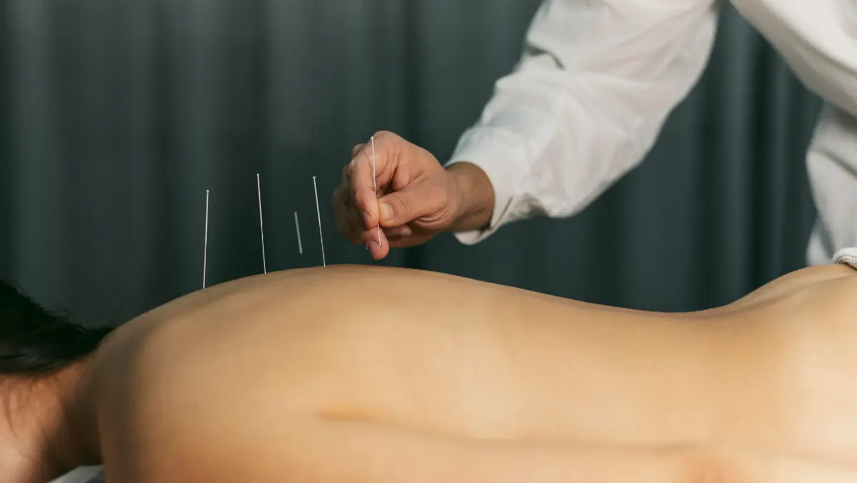 Acupuncture & Traditional Healing