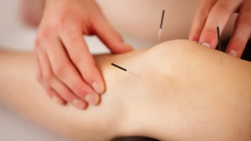 Specialized Acupuncture Treatments