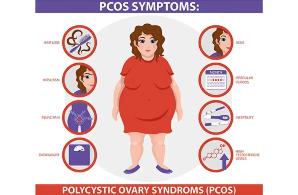 Natural Treatment for PCOS