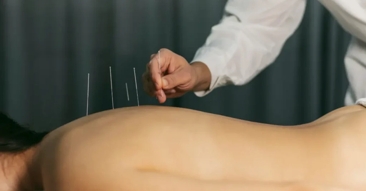 Acupuncture & Traditional Healing