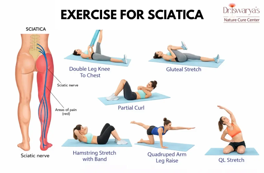 Sciatica Pain Relief Through Naturopathy