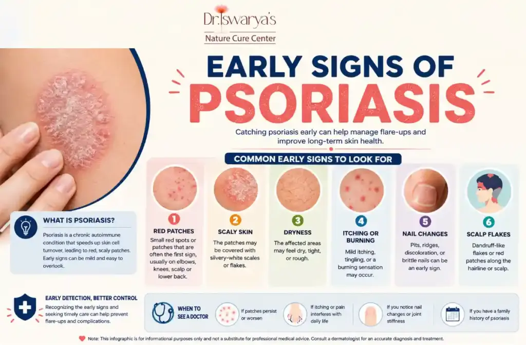 Best Psoriasis Treatment in Chennai