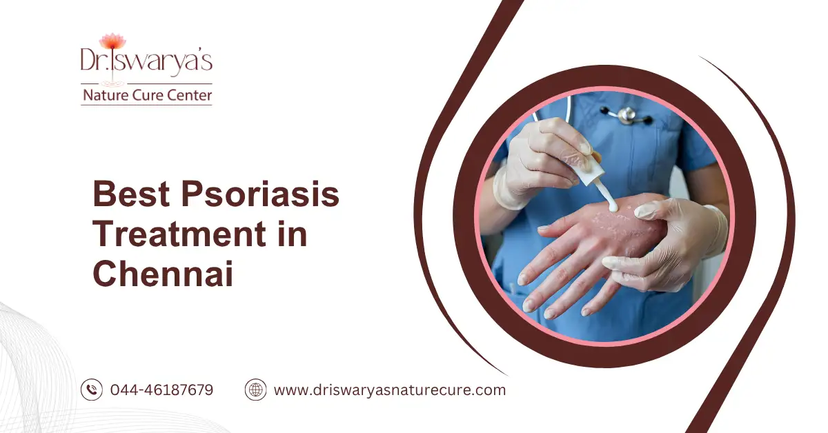 Best Psoriasis Treatment in Chennai