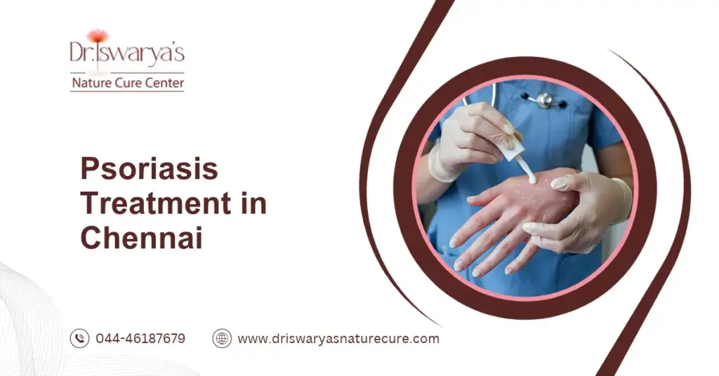 Psoriasis Treatment in Chennai