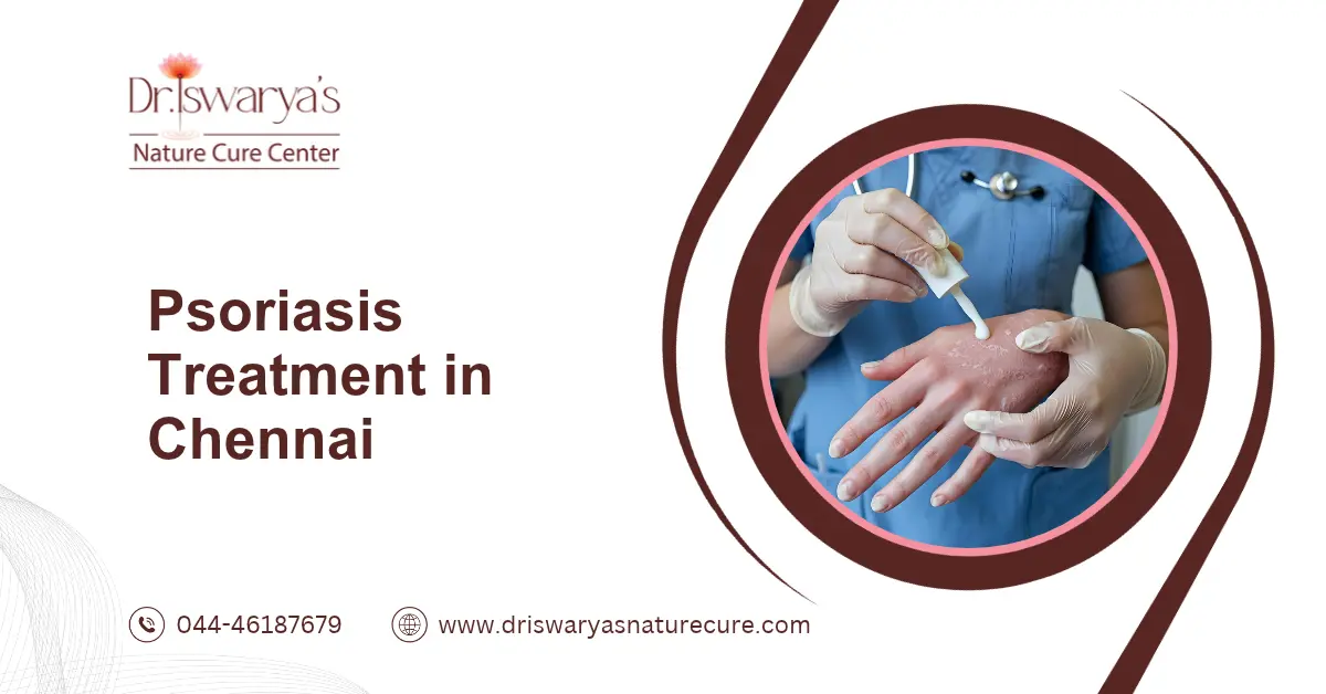Psoriasis Treatment in Chennai